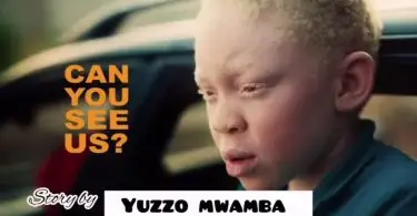 Yuzzo Mwamba Story Ya Albino